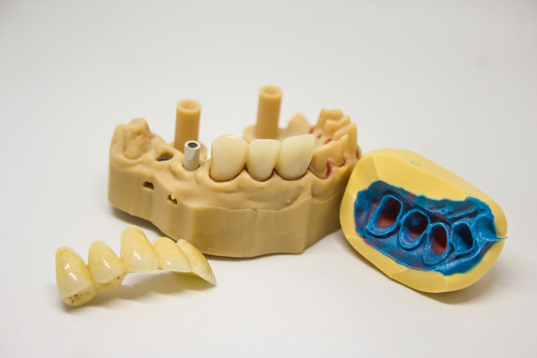 Affordable ClearChoice Dental Implants: Cost and Benefits